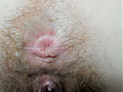 Extra cloused wink hairy asshole
